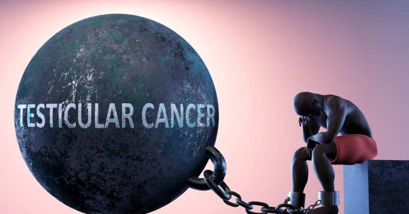 Testicular Cancer Spot the Symptoms Early