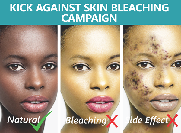 Why Black women in a predominately black culture are still bleaching their skin