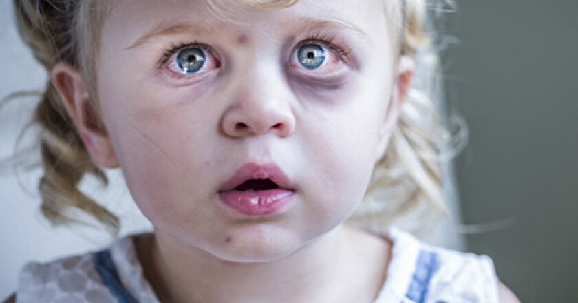 Reporting child abuse anonymously
